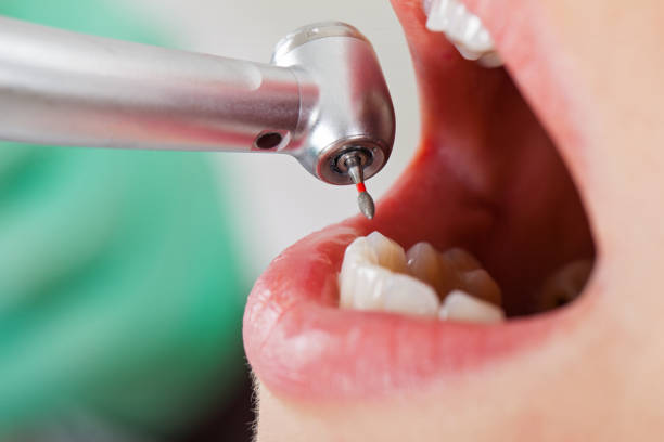 Best Walk-In Emergency Dental Services in Ferris, TX